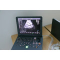 Laptop Color Doppler Ultrasound Machine